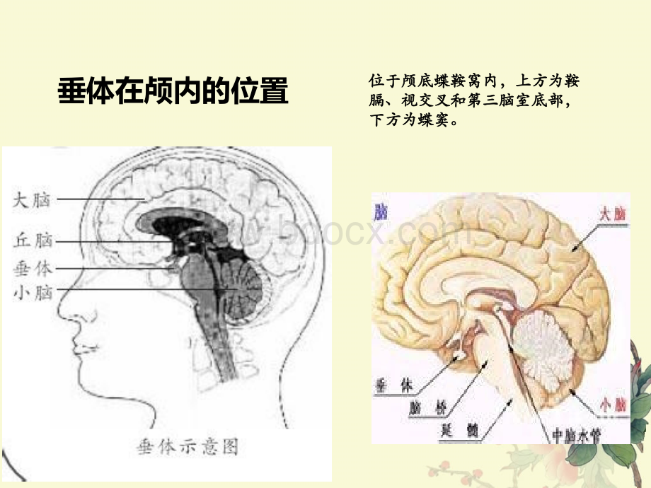 垂体瘤pptPPT文件格式下载.ppt_第3页