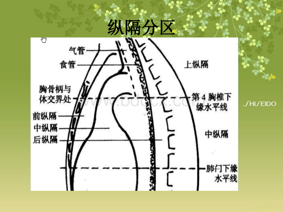 纵隔常见疾病的影像学表现.ppt_第3页