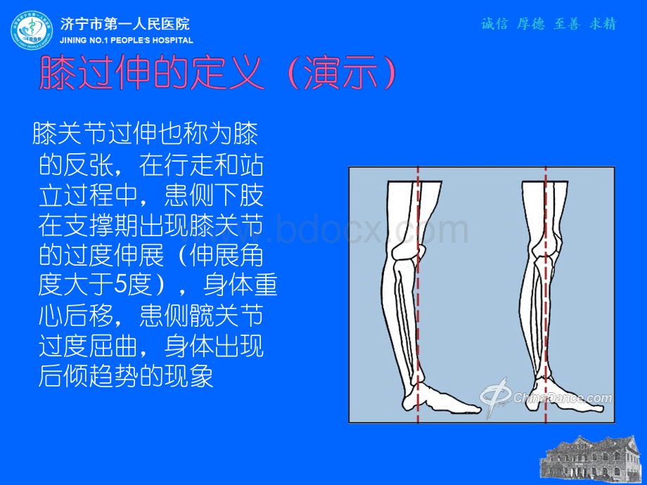 偏瘫患者膝关节过伸控制训练.ppt_第3页