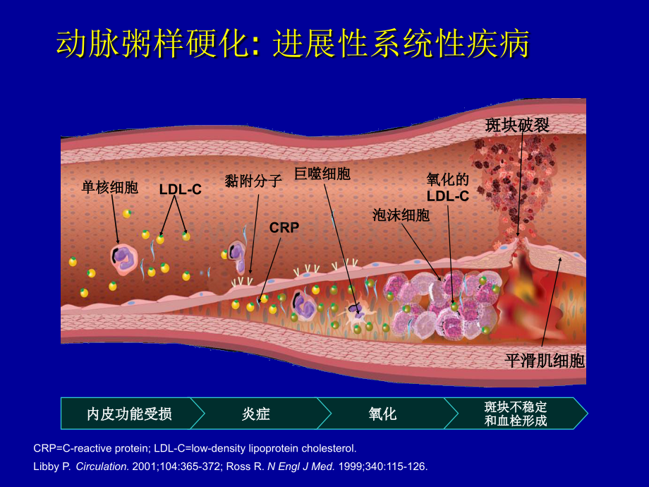 立普妥稳定逆转斑块研究荟萃--王海波.ppt_第2页