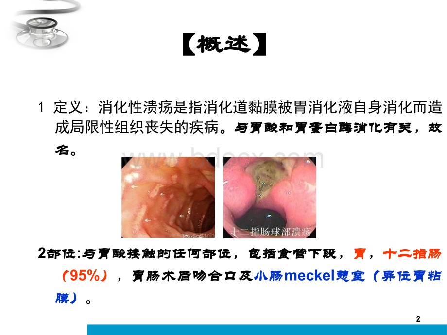 小儿消化性溃疡-ppt课件PPT文档格式.ppt_第2页