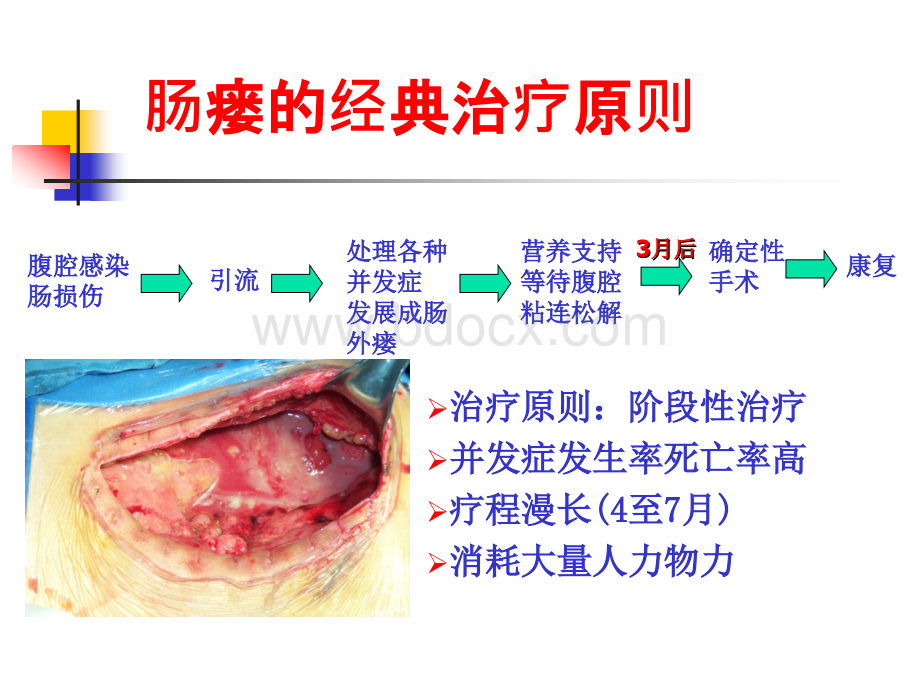 肠瘘病人的营养支持PPT格式课件下载.ppt_第3页