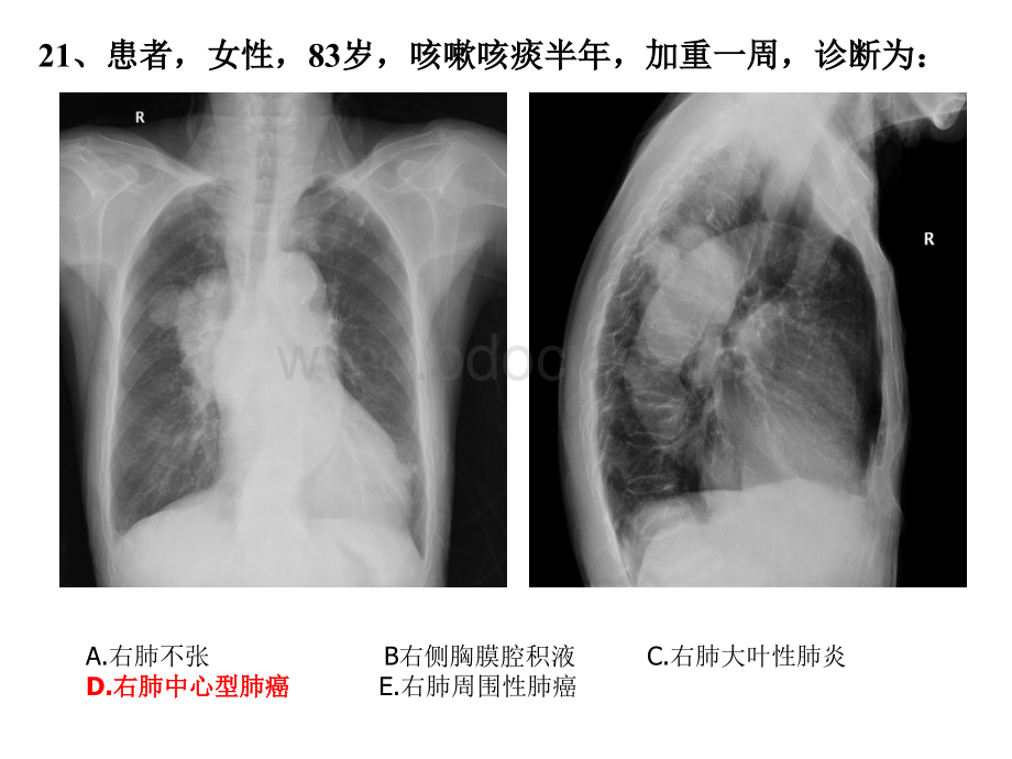 X线试题及答案PPT资料.ppt_第1页