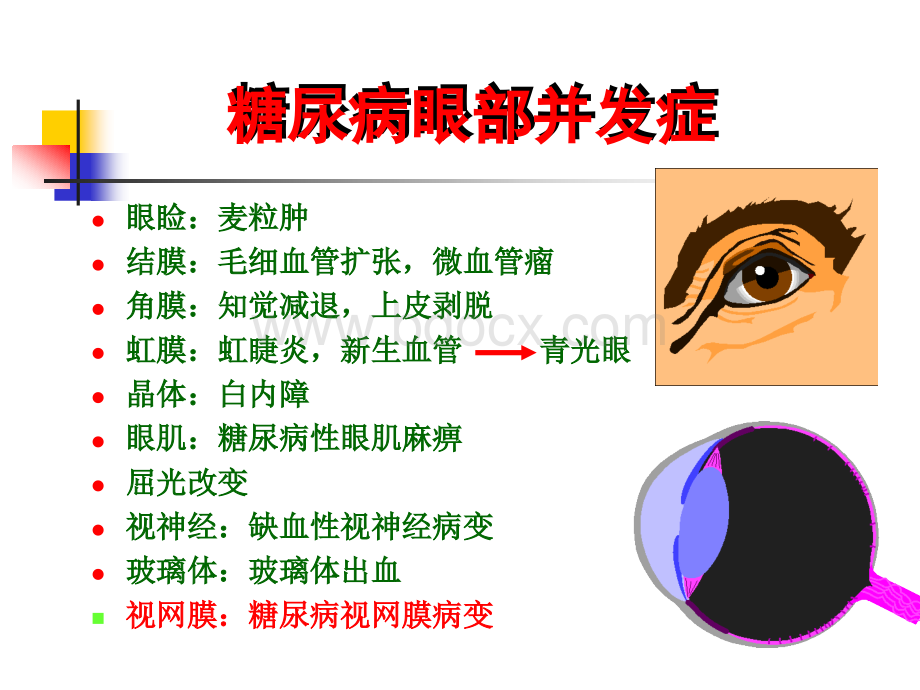 糖尿病视网膜病变1.ppt_第2页