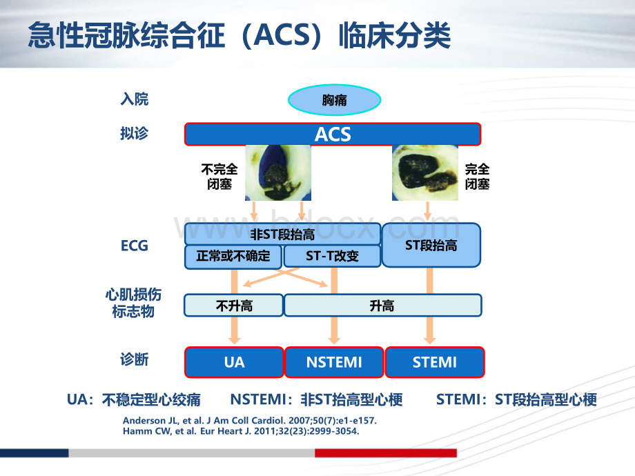 NSTE-ACS诊断标准和治疗原则解读PPT推荐.ppt_第3页