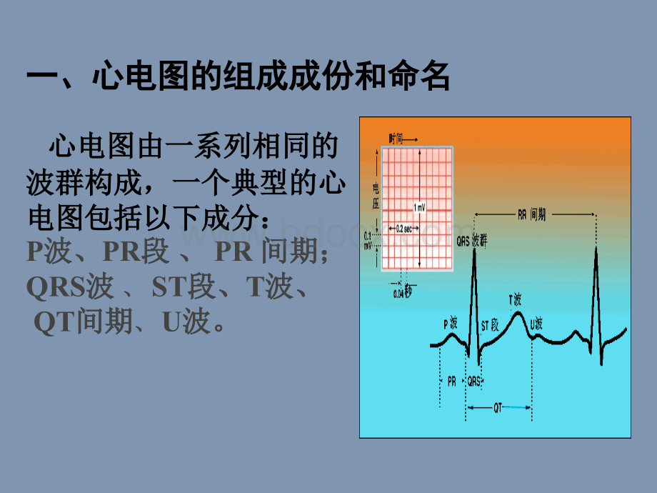 常见异常心电图的识别及药物应用.ppt_第3页