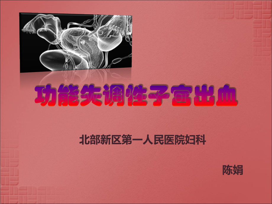 功能失调性子宫出血PPT.ppt