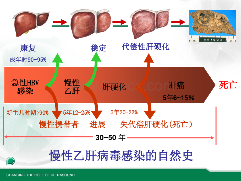 声诺维临床应用.ppt_第3页