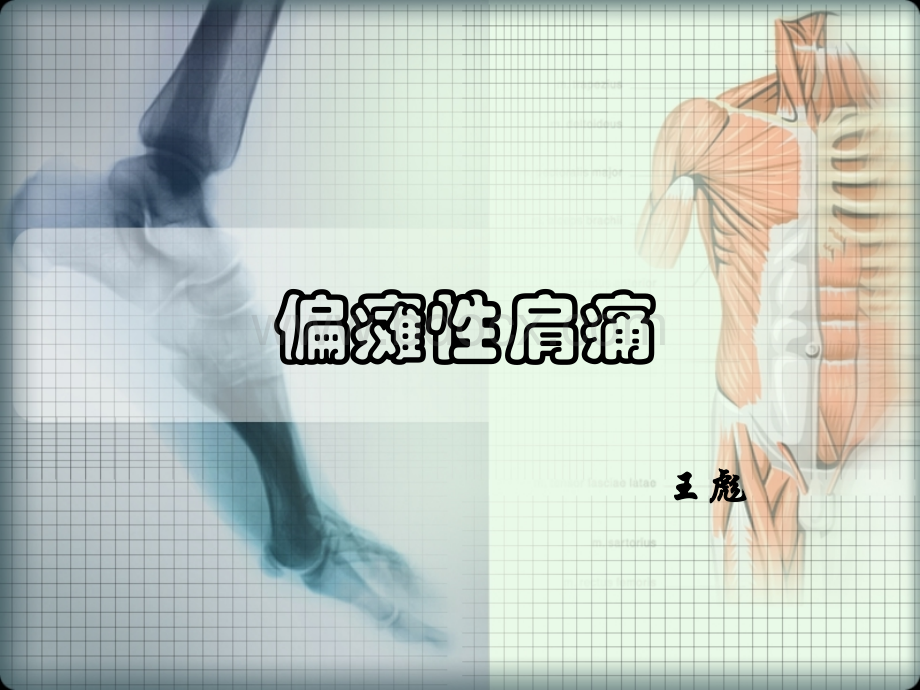 偏瘫性肩痛.ppt_第1页