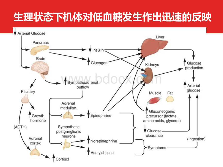 第五期低血糖症诊治-苏恒.pptx_第3页