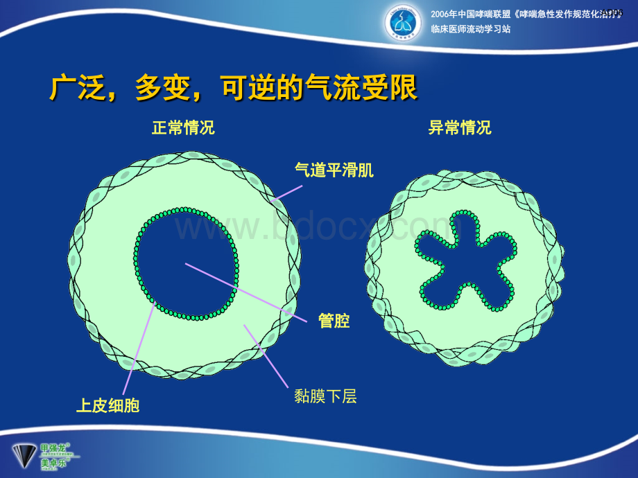 支气管扩张剂在支气管哮喘急性发作时的应用PPT资料.ppt_第2页