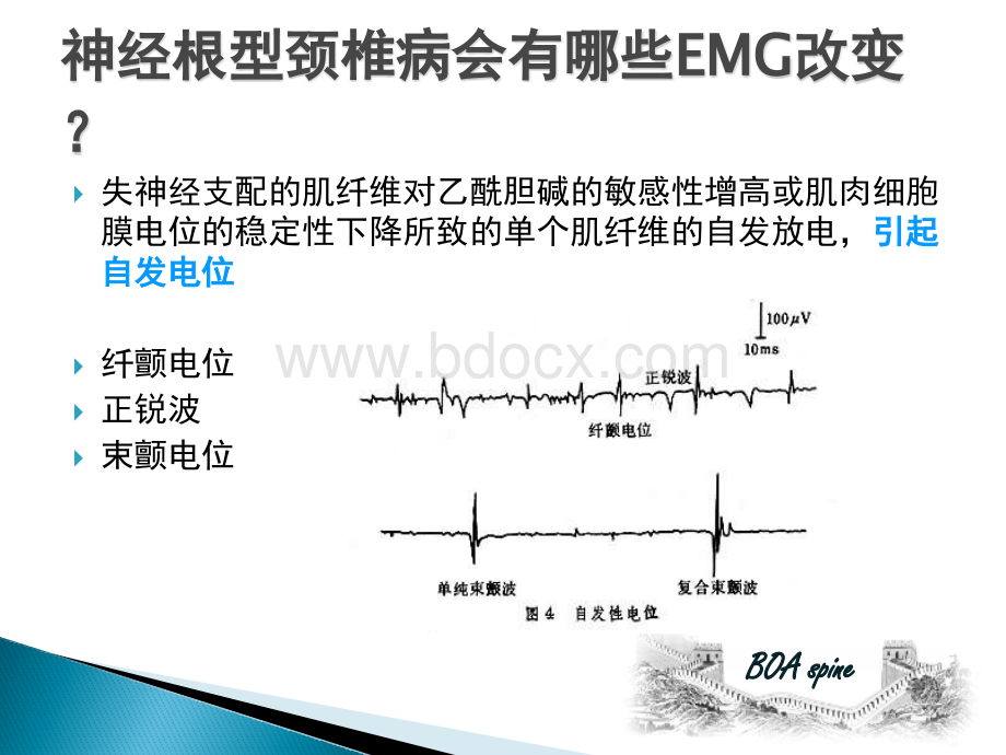 EMG及选择性神经根封闭在根型颈椎病评估中的作用到底有大？PPT推荐.pptx_第3页