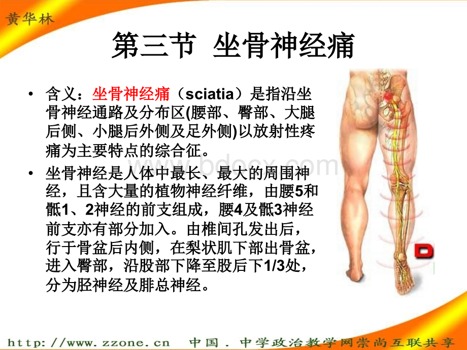 9坐骨痿证10痛风优质PPT.ppt