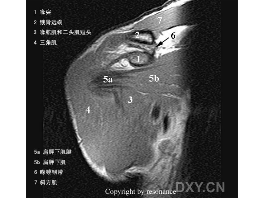 肩关节正常MRI解剖图谱.ppt_第3页