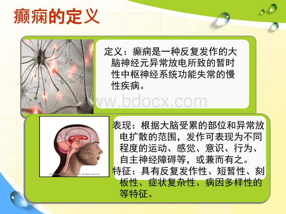 癫痫患者的护理.ppt_第3页