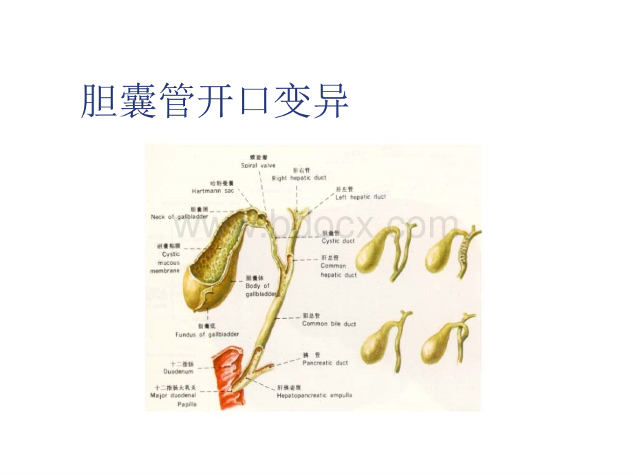 胆囊结石的中西医诊治.ppt_第3页