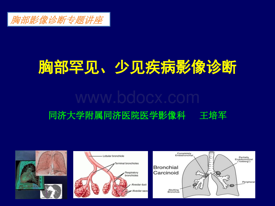 胸部少见罕见疾病影像诊断.ppt