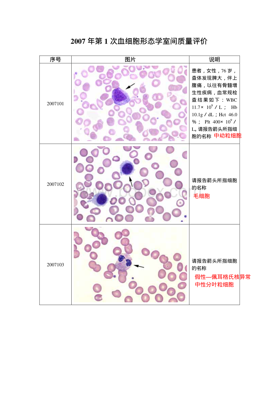 检中心血细胞形态学检查室间质量评价及答案.pdf_第1页