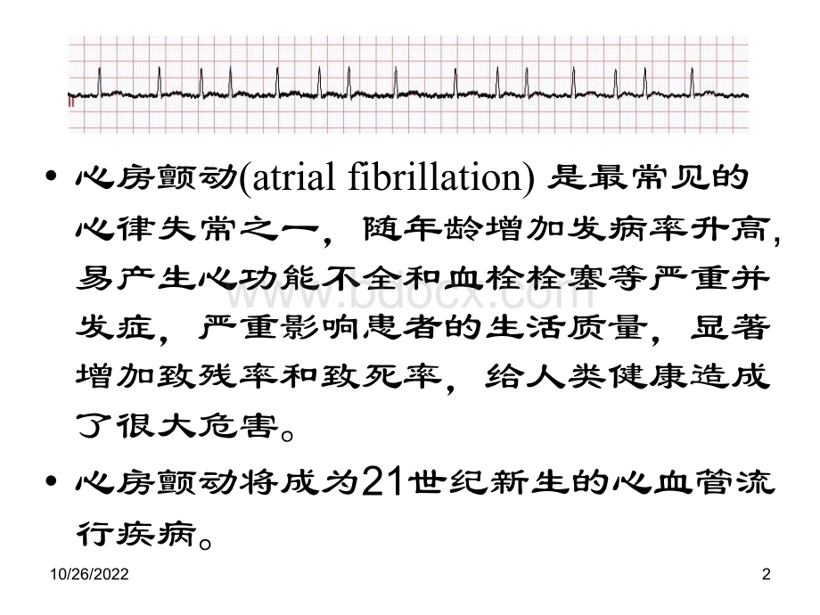 心房颤动治疗策略.ppt_第2页