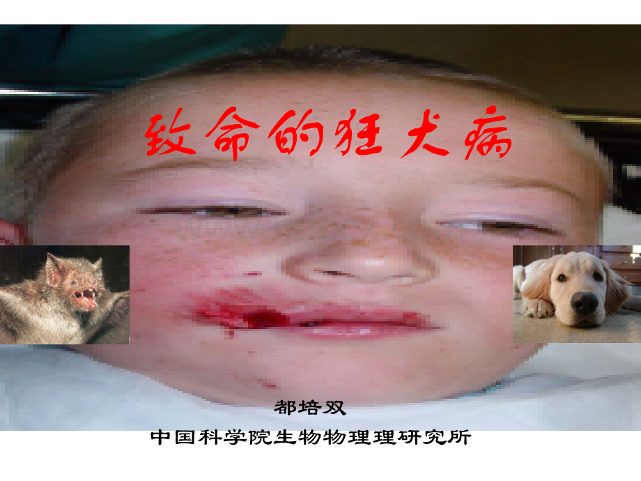 致命的狂犬病_精品文档.ppt