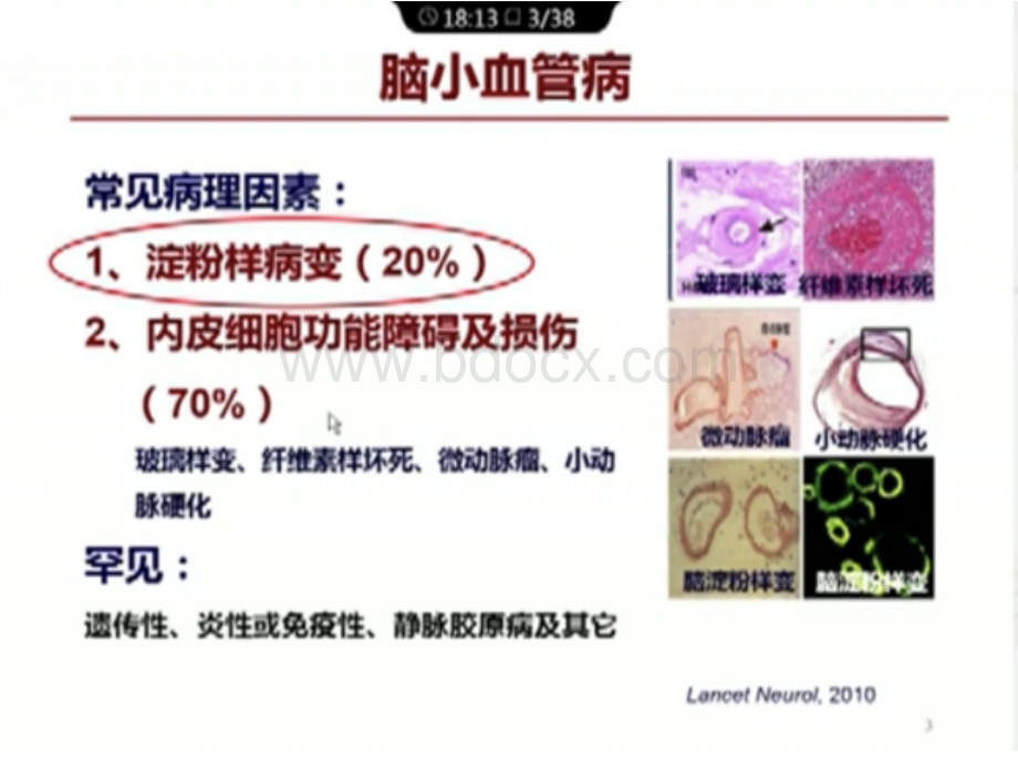 脑小血管病研究动物模型制备和相关选择PPT格式课件下载.ppt_第3页