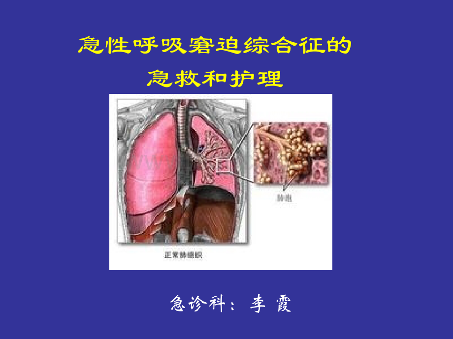 急性呼吸窘迫综合征的急救和护理PPT推荐.ppt