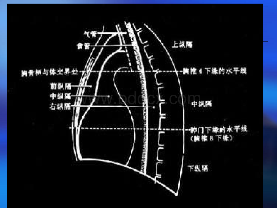 纵隔病变PPT课件下载推荐.ppt_第3页