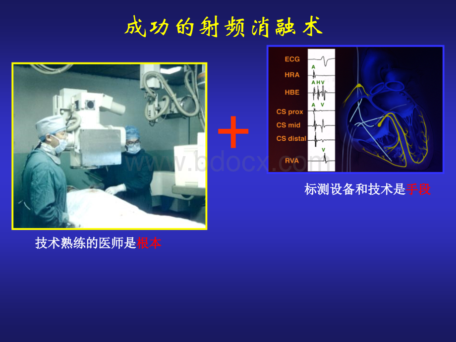 心脏电生理介入治.ppt_第3页