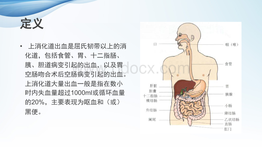 上消化道大出血的急救护理PPT文件格式下载.pptx_第3页