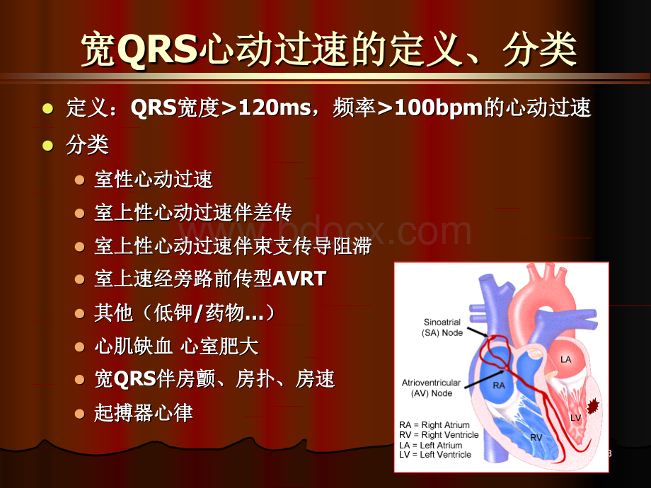 宽QRS心动过速的鉴别诊断.ppt_第3页