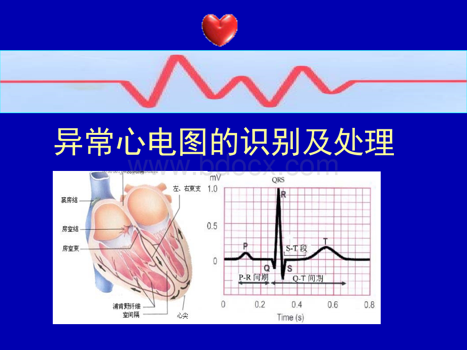 异常心电图的识别和处理.ppt