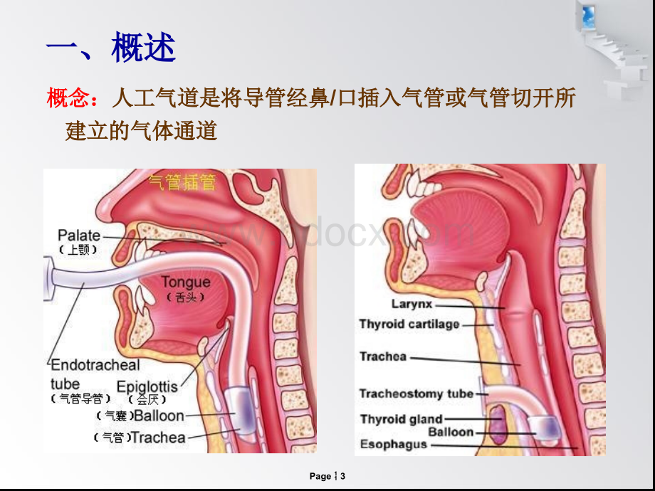 人工气道管理护理进展.ppt_第3页