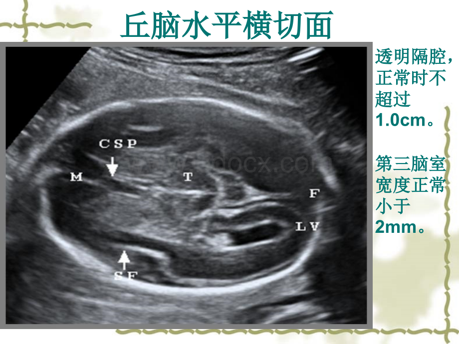 中孕期胎儿超声检查标准切面.ppt_第3页