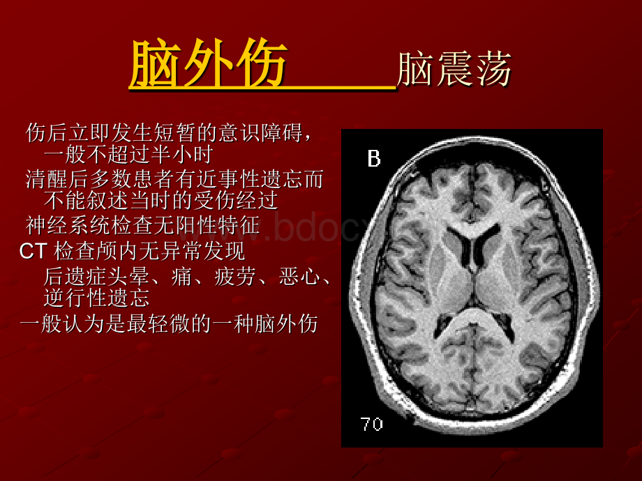 常见的脑外伤PPT资料.ppt_第2页