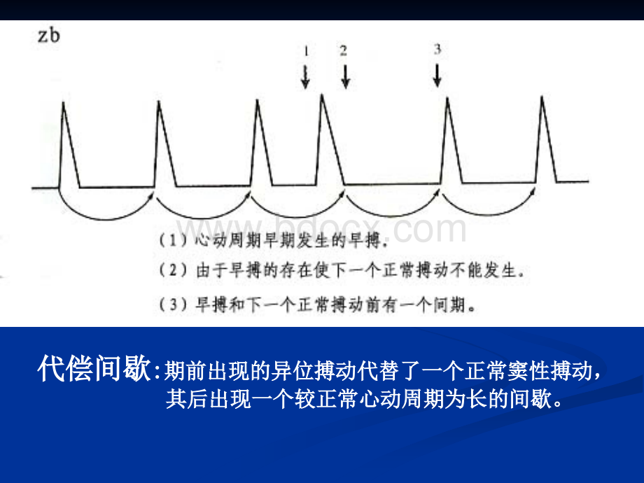 心律失常1实验诊断PPT推荐.ppt_第3页