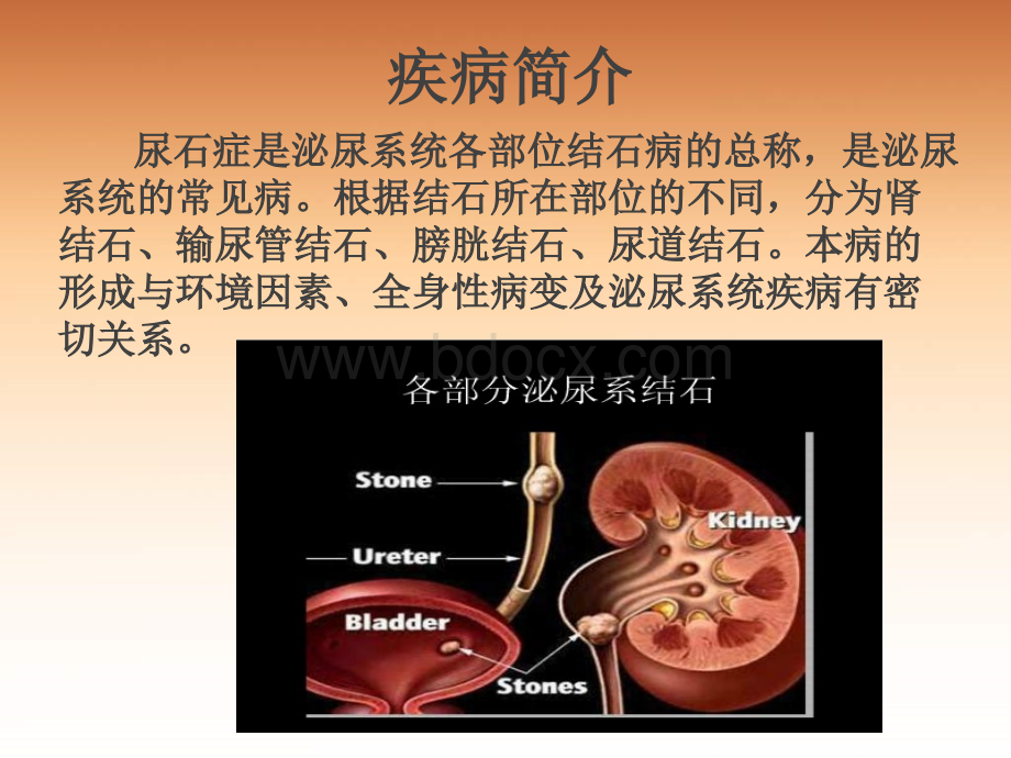 排石颗粒-产品PPT介绍.ppt_第2页