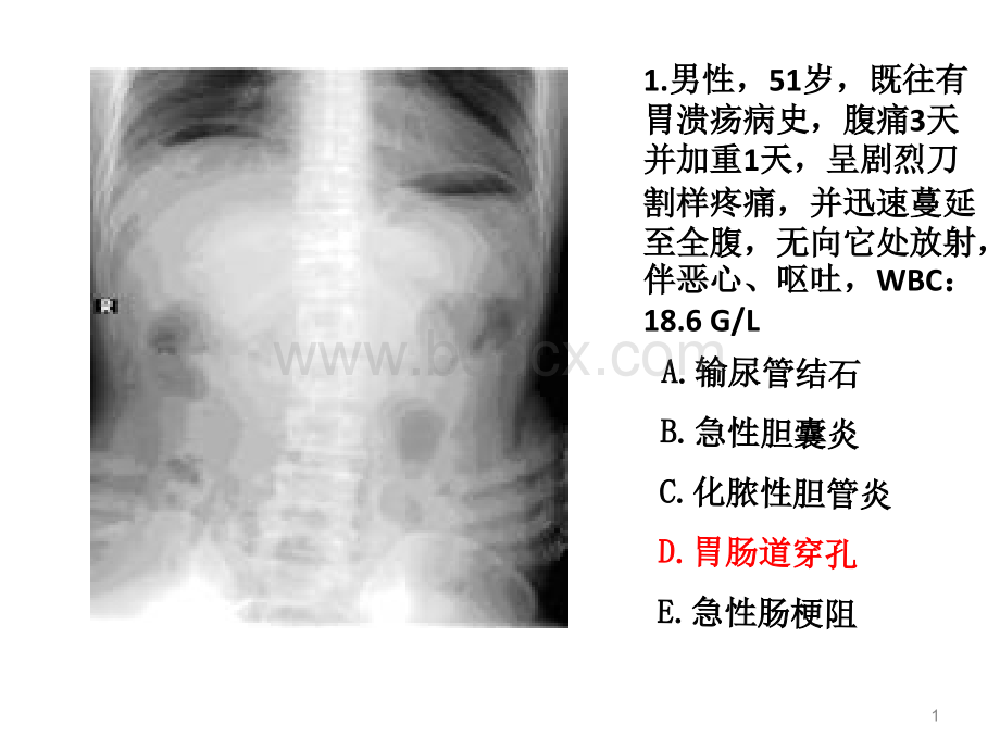 住院医师规陪出科考试辅助检查1.ppt_第1页