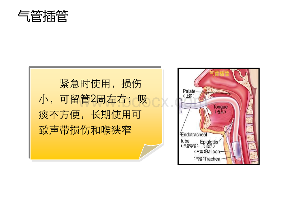 气管插管和气道湿化.ppt_第2页