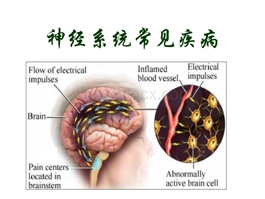 神经系统常见疾病PPT.ppt