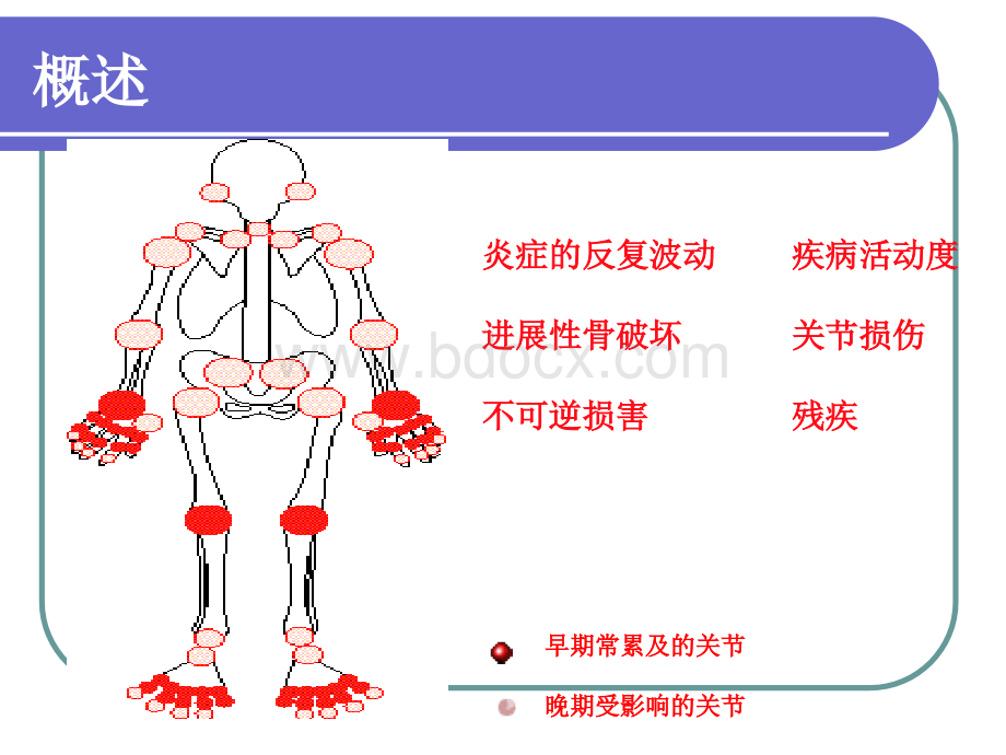 炎_精品文档_001.ppt_第2页