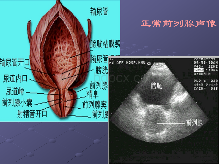 前列腺等超声诊断.ppt_第3页