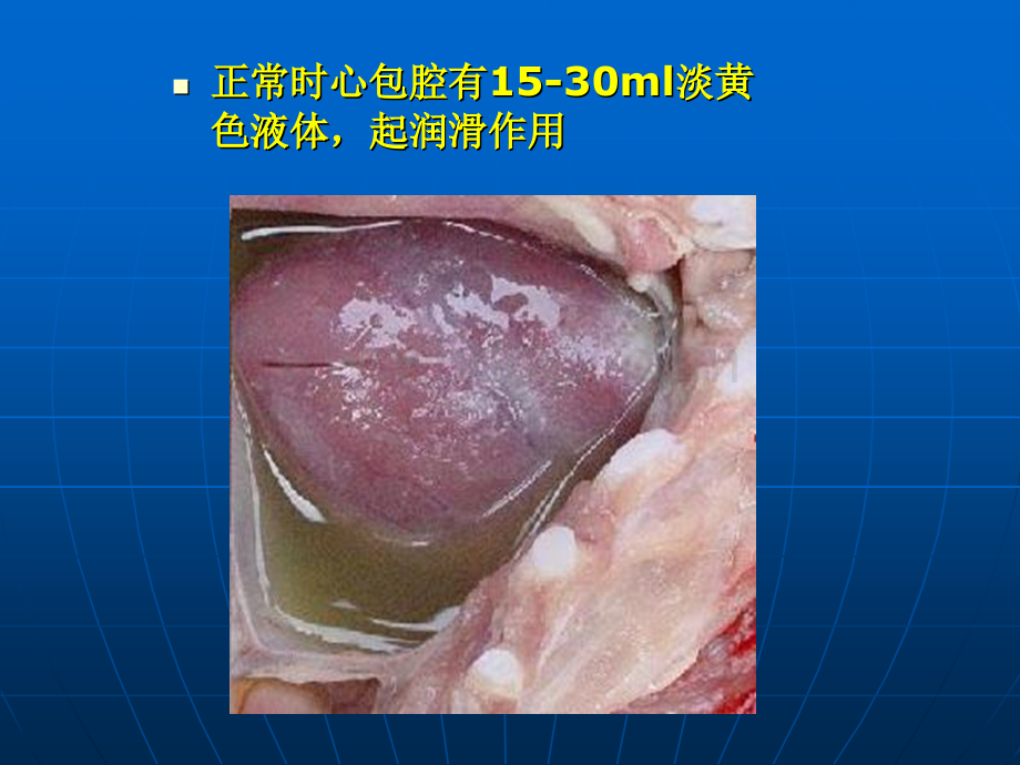 心包积液PPT医学课件PPT文件格式下载.ppt_第3页