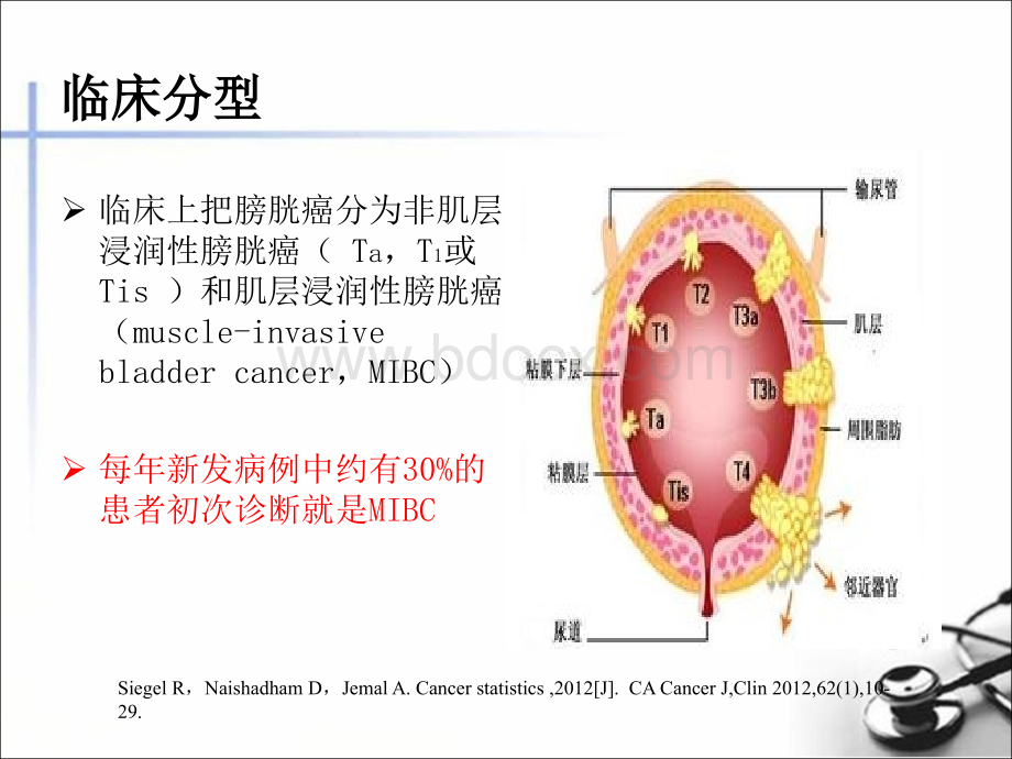 肌层浸润性膀胱癌保留膀胱术后不同辅助治疗方法疗效评价PPT推荐.pptx_第3页