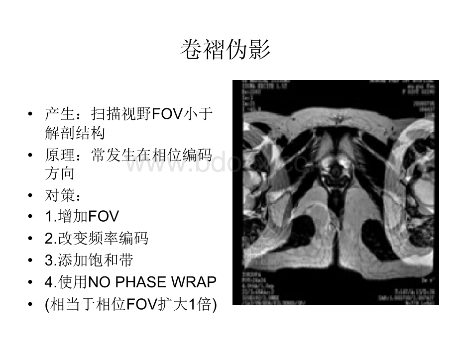 常见MR伪影及对策.ppt_第2页