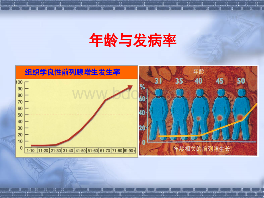 良性前列腺增生症的中西医诊治_精品文档.ppt_第3页