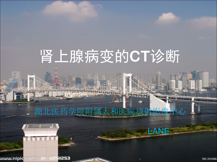 肾上腺病变CT诊断.ppt