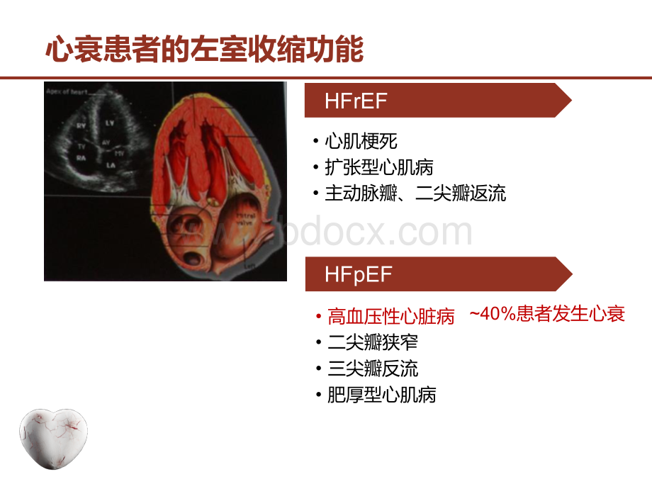 ESC--慢性心衰的药物治疗MCC.pptx_第3页