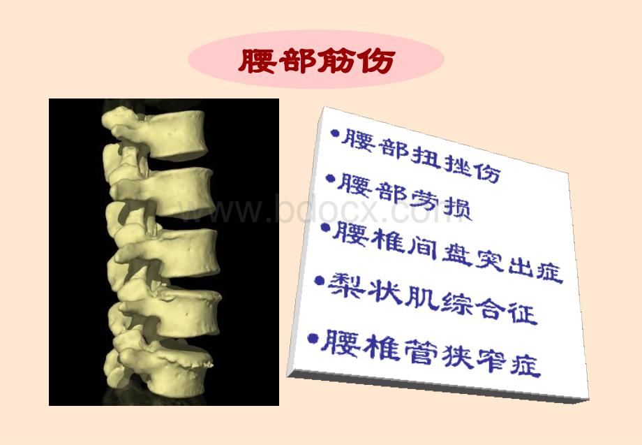 中医伤科腰部筋伤PPT资料.ppt