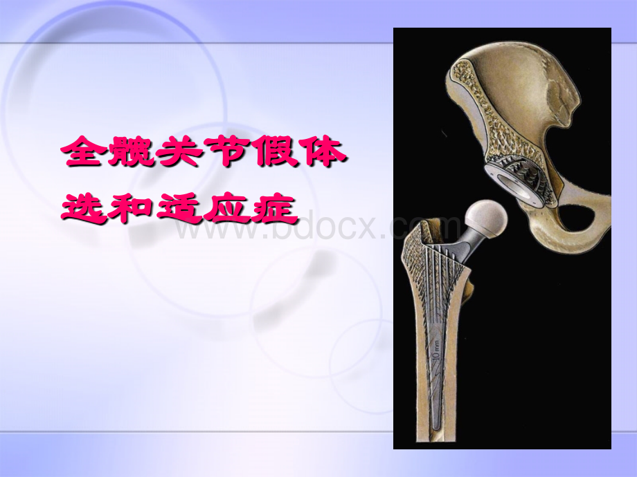 全髋假体选择和适应症.ppt