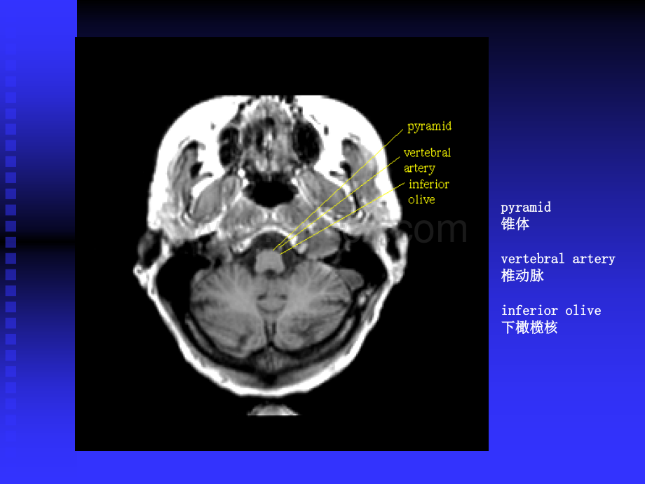 神经影像学培训教材.ppt_第3页